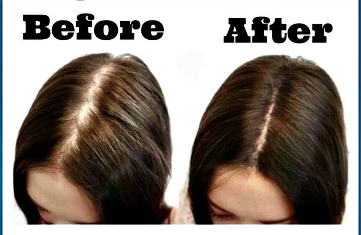 how to regrow hair