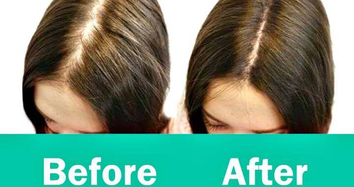 How To Regrow Hair Best Natural Ways To Regrow Hair Before