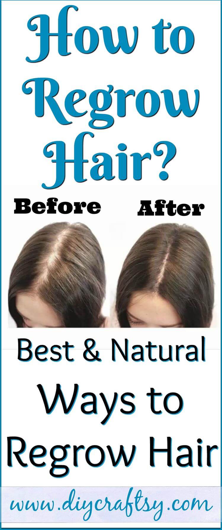 How To Regrow Hair Best Natural Ways To Regrow Hair Before