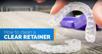 how to clean a clear retainer